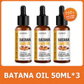 Lewedo Naturals Batana Oil Fast Hair Growth for Men Women Pure Batana Oil Nourish Shiny Hair Healthy Hair Care Anti Hair Loss Oasis Select 3pcs batana oil
