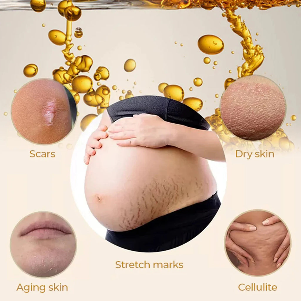 EELHOE Olive Body Oil – Moisturize, Soften & Tone Skin 150ml
