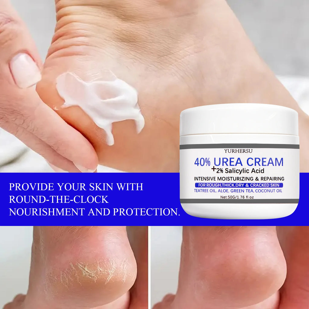 YURHERSU 40% Exfoliating Foot Cream for Dry Cracked Heels 50g