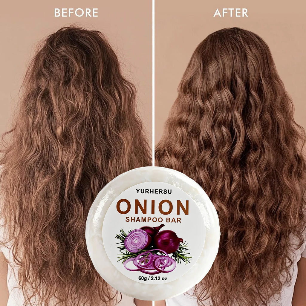 Vegan Onion Shampoo Bar – Oil Control, Frizz & Scalp Care Solid Shampoo Bar Oasis Select 1pcs ALOE 120g