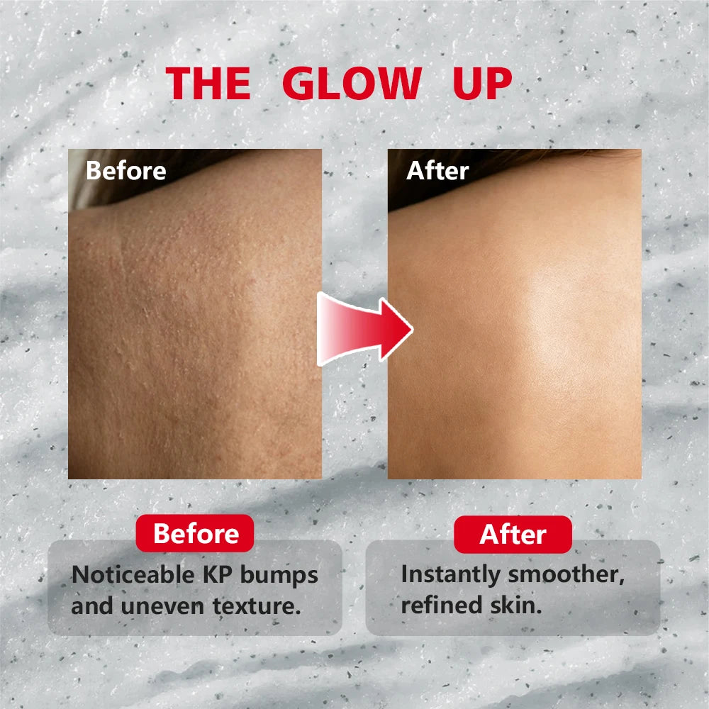 Bump Eradicator Body Scrub Smooth Soothed Brighten Skin Deep Moisturizing Formula Improve Rough Skin Gentle Remove Dead Skin Oasis Select