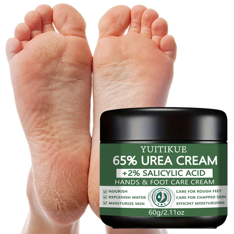 65% Urea Foot & Hand Cream – Cracked Heel Repair 60g
