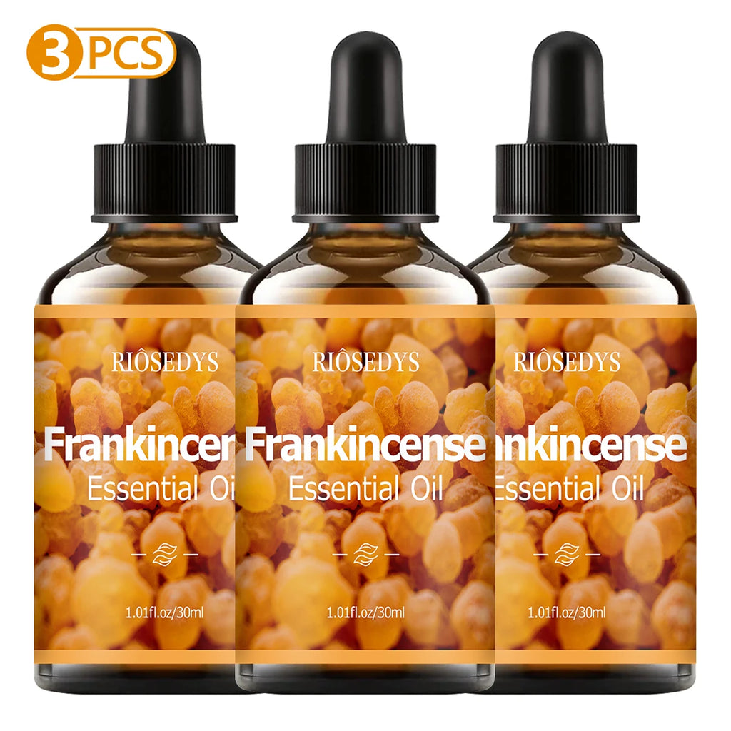 Frankincense Essential Oil – Massage, Hair Care & Diffuser