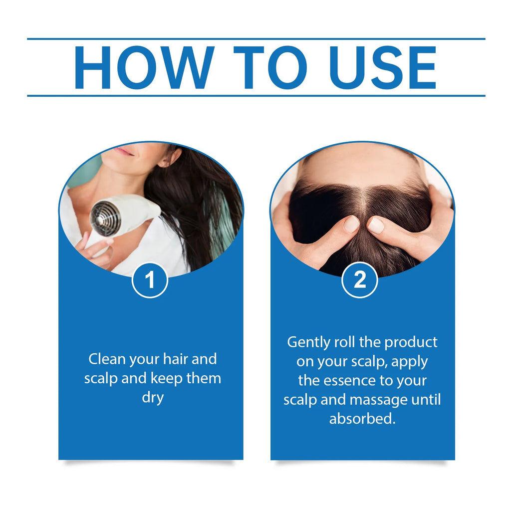 Rosemary Hair Growth Roller Essence Improves Scalp Health Stimulates Follicle Activity Reduces Hair Breakage Increases Density Oasis Select