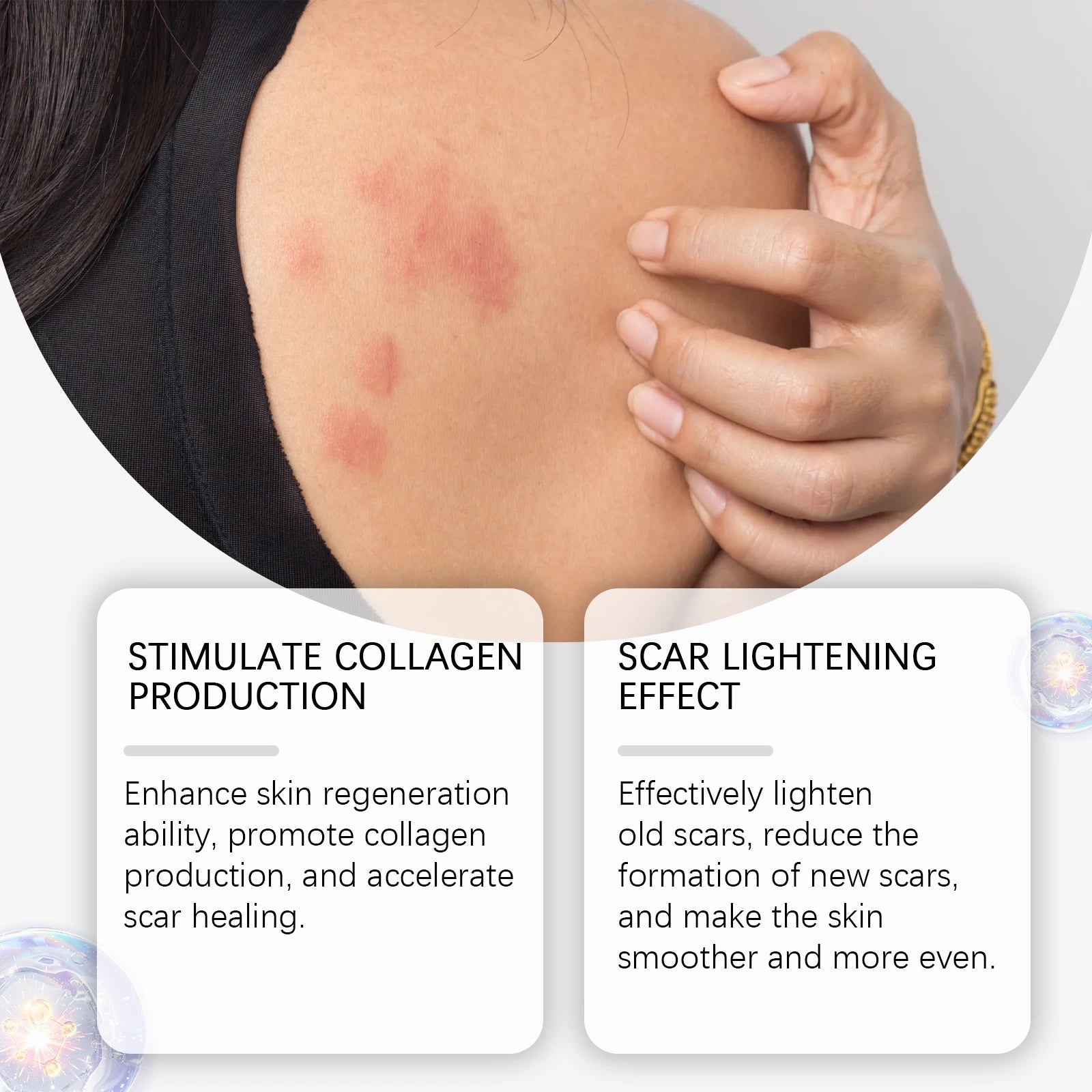 Eelhoe Herbal Collagen Cream – Scar & Moisturizer 50g