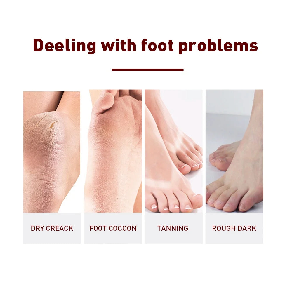 1 Pair Exfoliating Feet Mask Exfoliating Foot Peel Mask Socks Pedicure Peeling Dead Skin Remover Feet Mask Peel Moisturizing Oasis Select