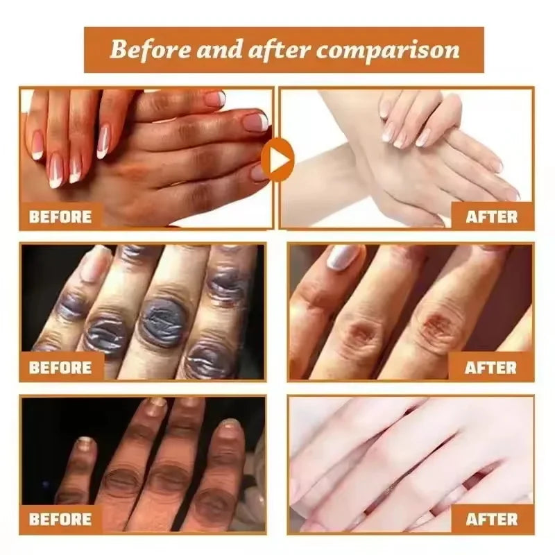 Dark Knuckle Brightening Hand Cream | Melanin Corrector 30g
