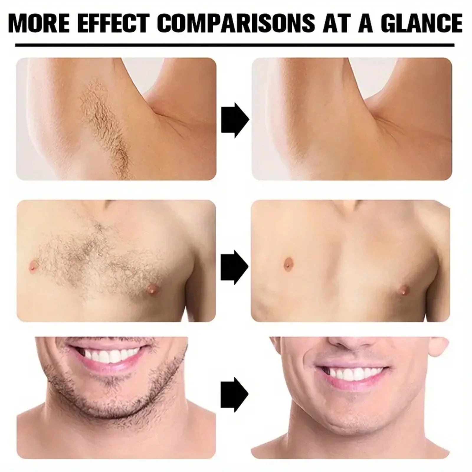 Hair Removal Cream Permanent Epilator Cream Intimate Areas Health Painless Hair Remover Growth Inhibitor for Woman Men Body Care Oasis Select