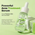 AUQUEST Face Serum Hyaluronic Acid Moisturizing Whitening Oil-Control Acne Treatment Anti-Aging Freckle Removal Facial Skin Care Oasis Select Acne Treatment Serum China Mainland