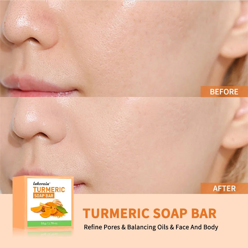 Handmade Turmeric Soap Bar – Brightening Face & Body Cleanser