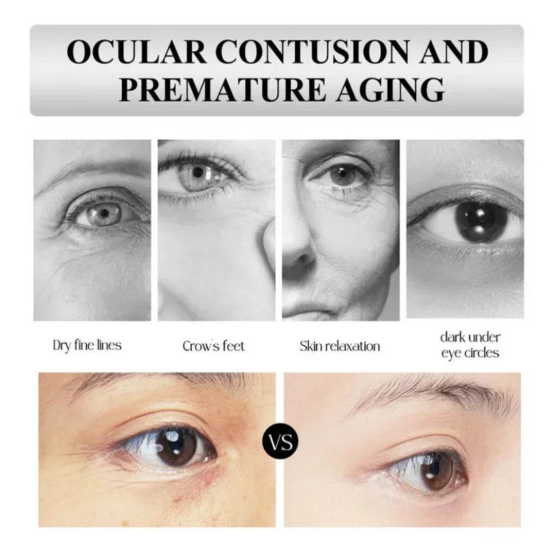 Retinol Eye Cream – Firming, Dark Circle & Hydrating 15ml Eye Cream Oasis Select