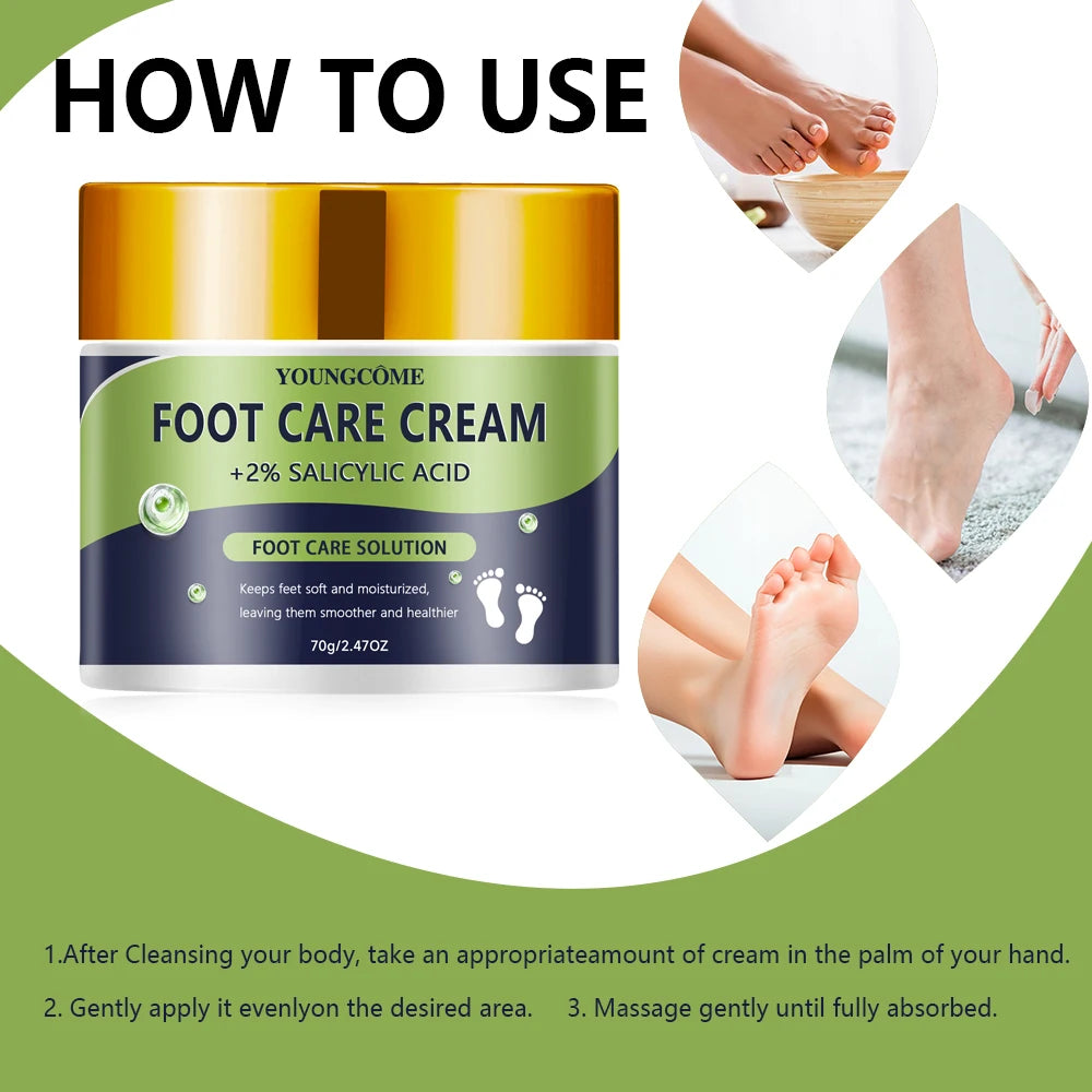 YOUNGCOME 2% Salicylic Acid Foot Cream – Moisturizing & Softening