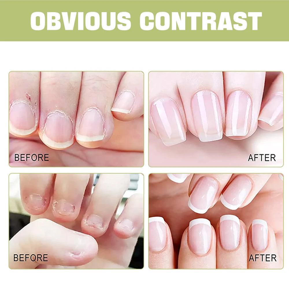 EJW Cuticle Oil – Nourishing Nail & Cuticle Treatment Cuticle Oil Treatment Oasis Select