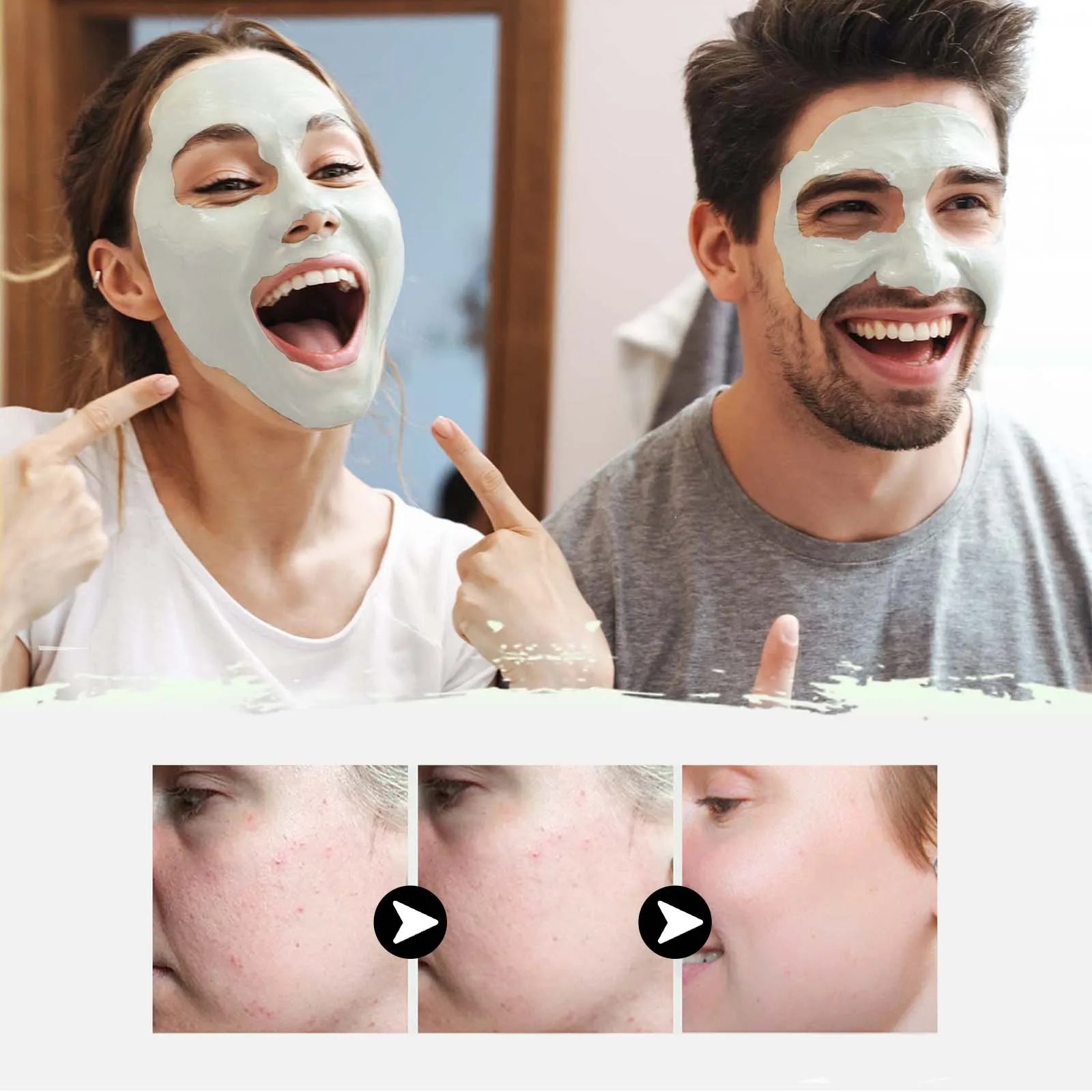 40g 4 pcs Blackhead Cleansing Mud Film, Dilute Acne and Acne Marks, Tighten Pores, Deeply Clean and Moisturize The Skin Oasis Select