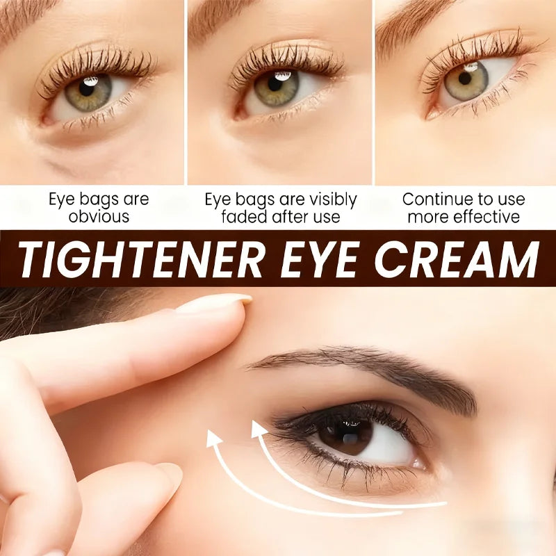 Botax Eye Cream 24H Lifting – Vitamin C, Retinol & Bee Venom Anti-Aging Eye Cream Oasis Select