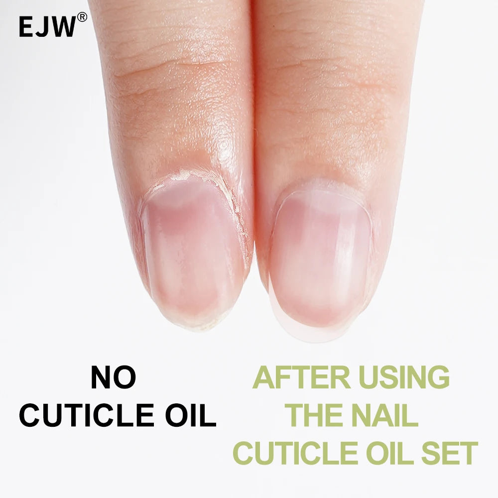 EJW Cuticle Oil – Nourishing Nail & Cuticle Treatment Cuticle Oil Treatment Oasis Select