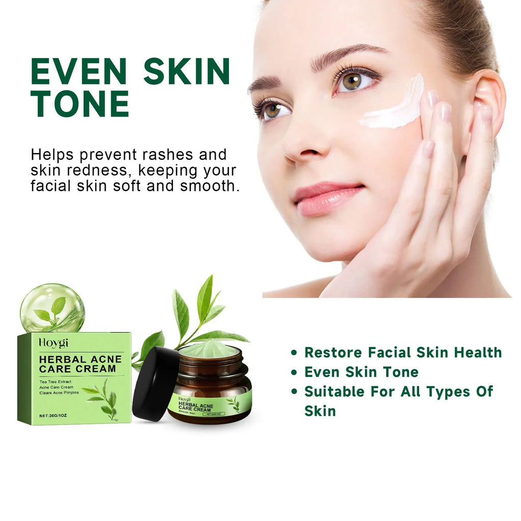Hoygi Acne Face Cream – Salicylic Acid Pore Serum
