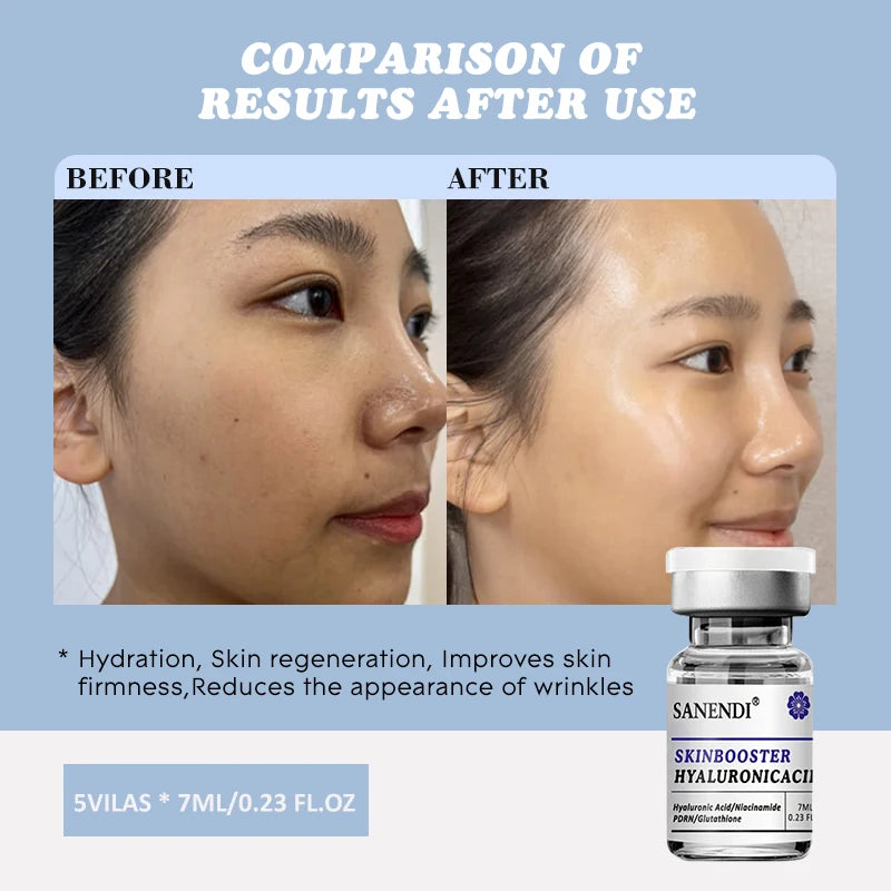 Sanendi Hyaluronic Acid PDRN Glutathione Retinol Serum 5×7ml Face Serum Oasis Select 1BOX
