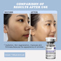 Sanendi Hyaluronic Acid PDRN Glutathione Retinol Serum 5×7ml Face Serum Oasis Select 1BOX