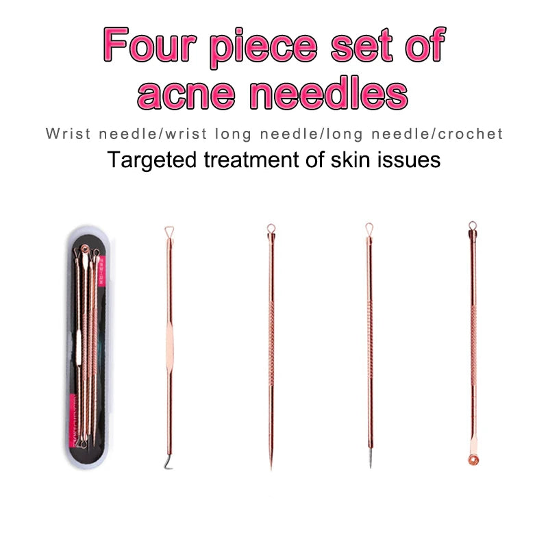4-Piece Comedone Extractor Kit – Stainless Steel Blemish Tools