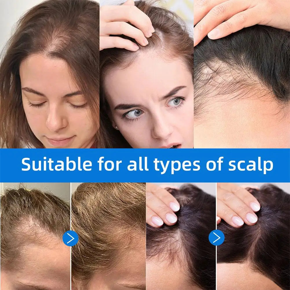Seapuri Scalphy Hair Essence Rollerball Nourishing Anti-Frizz Hair Serum Refreshing Strengthening Hair Essence Scalp Treatment Oasis Select