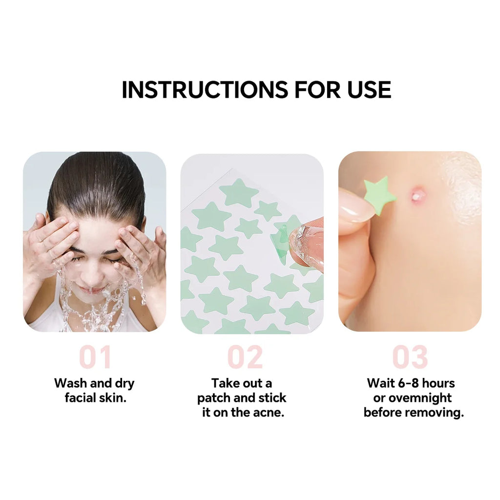 200pc Star Hydrocolloid Acne Patches – Ultrathin & Breathable
