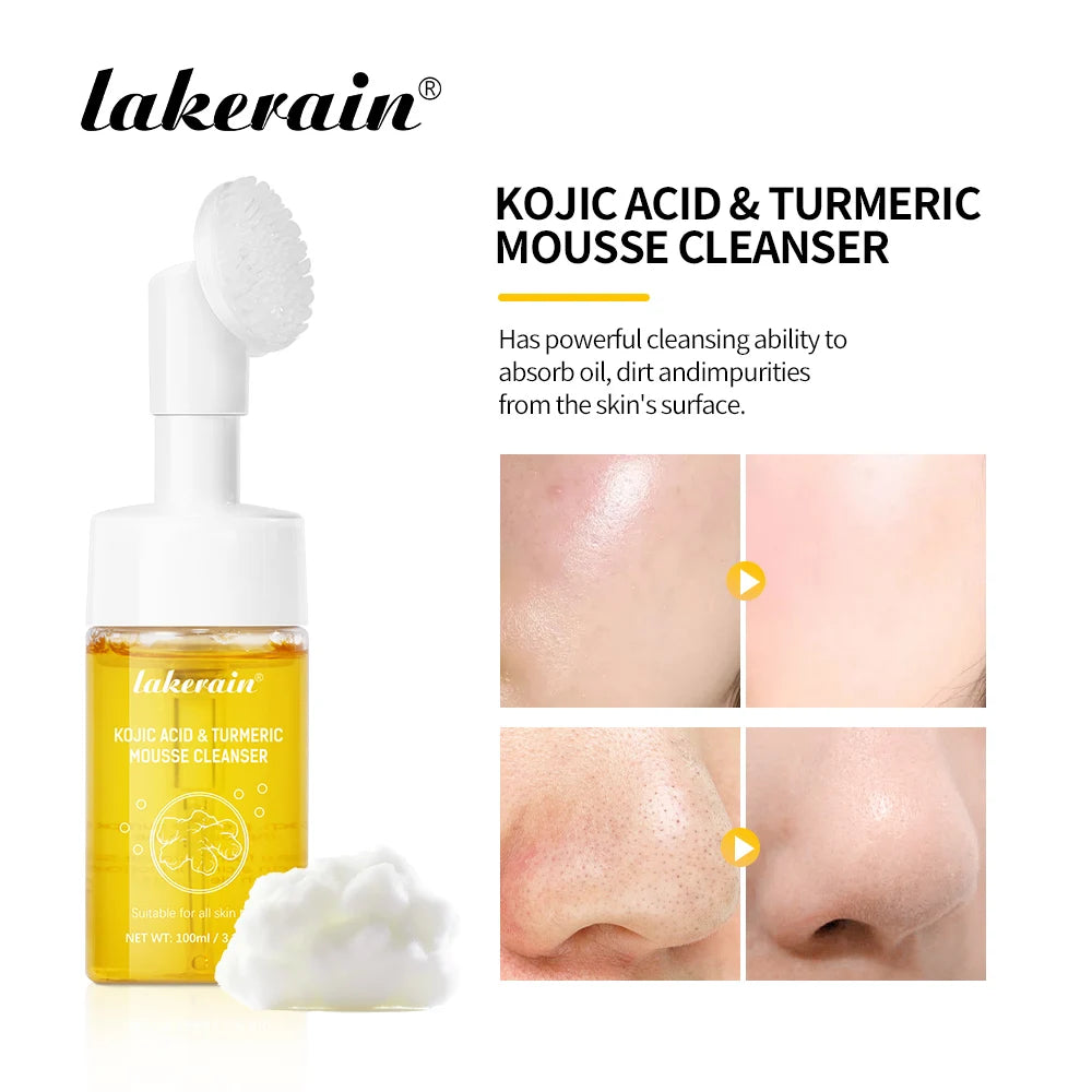 Turmeric Cleanser Deeply Cleansing Kojic Acid Blackhead Remover Skin Cleansing Oil Control Fade Acne Marks Brighten Foam Cleanse Oasis Select
