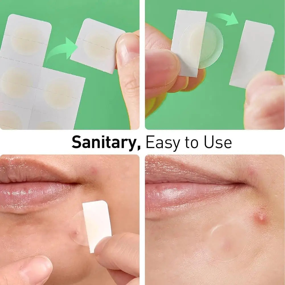 Hydrocolloid Acne Patches – Hyaluronic Acid Blemish Dots Acne Spot Patches Oasis Select