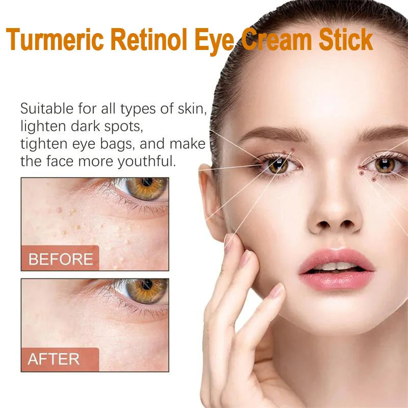 Hoygi Eye Cream | Dark Circles, Puffiness & Fine Lines Eye Cream Oasis Select