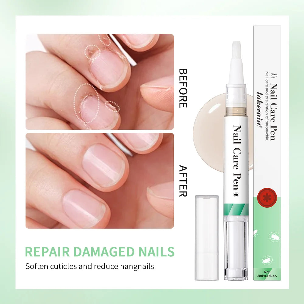 Nail Care Pen Nourish and Moisturize Nails Prevent Fungal Infections Improve Appearance Flat Brush Head Design Daily Nail Care Oasis Select