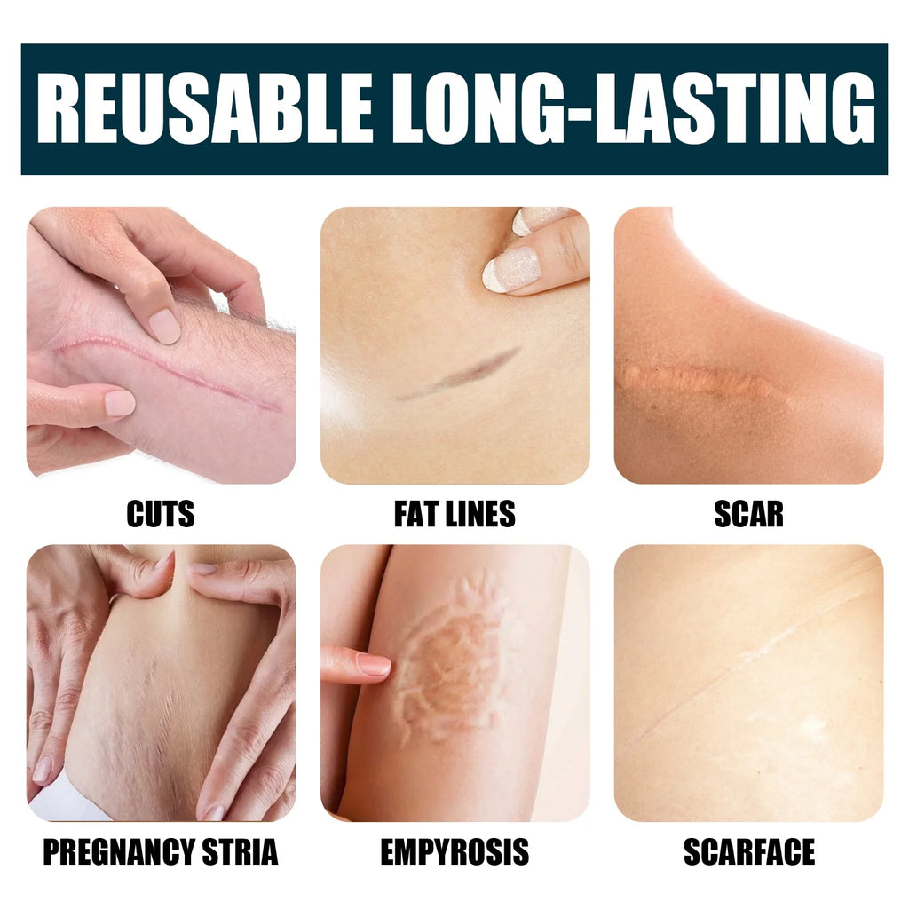 Nourishing Body Skin Cream Gel – Glycerin Moisturizer