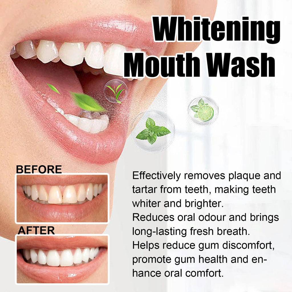 Coconut Mint Pulling Oil Mouthwash Kit With Tongue Scraper Fresh Oral Breath Odor Removal Alcohol-Free Whiten Tool Mouth Care Oasis Select