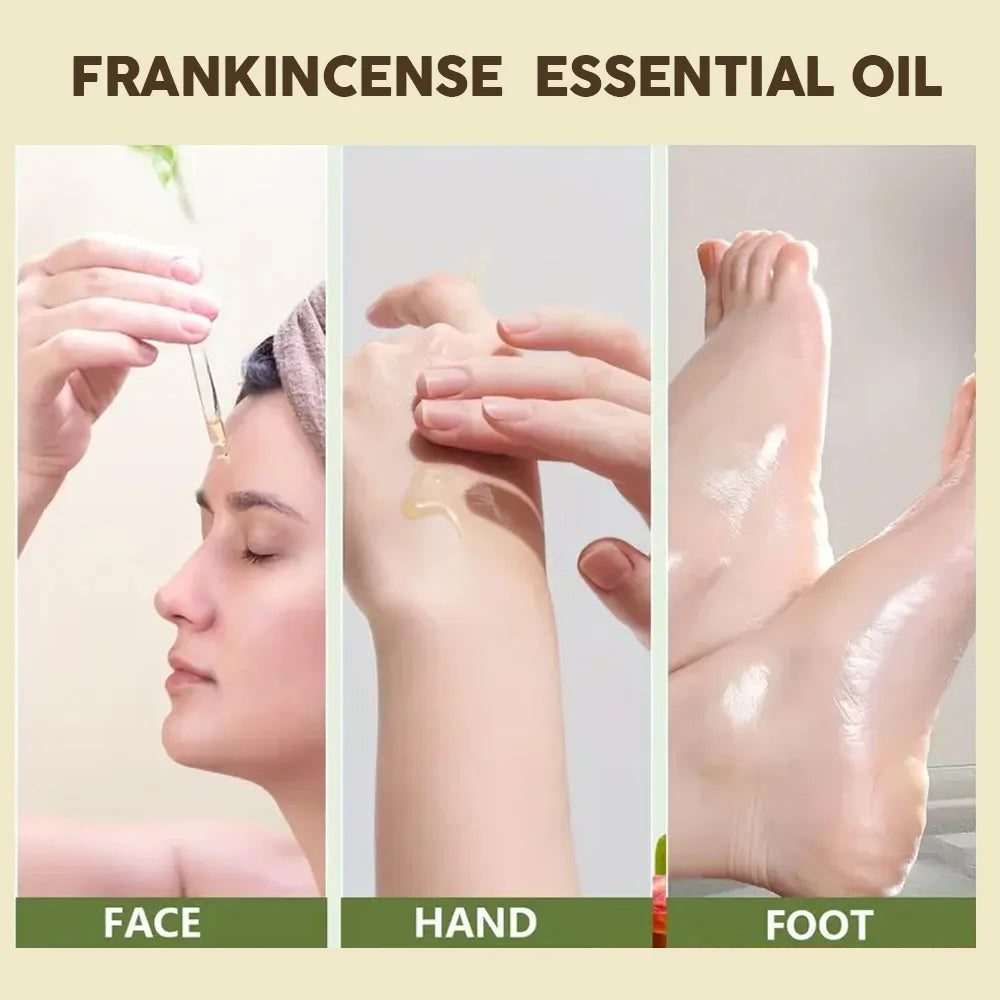 Frankincense Essential Oil – Face, Body & Hair Moisturizer
