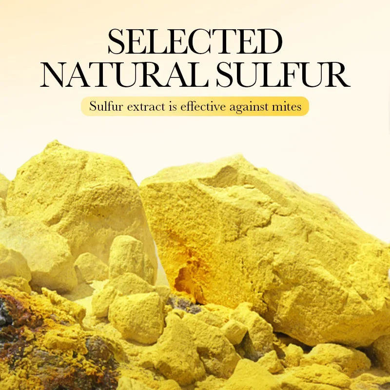 Sadoer Sulfur Cleansing Soap – Face & Body Moisturizing Bar Facial Cleansing Soap Oasis Select