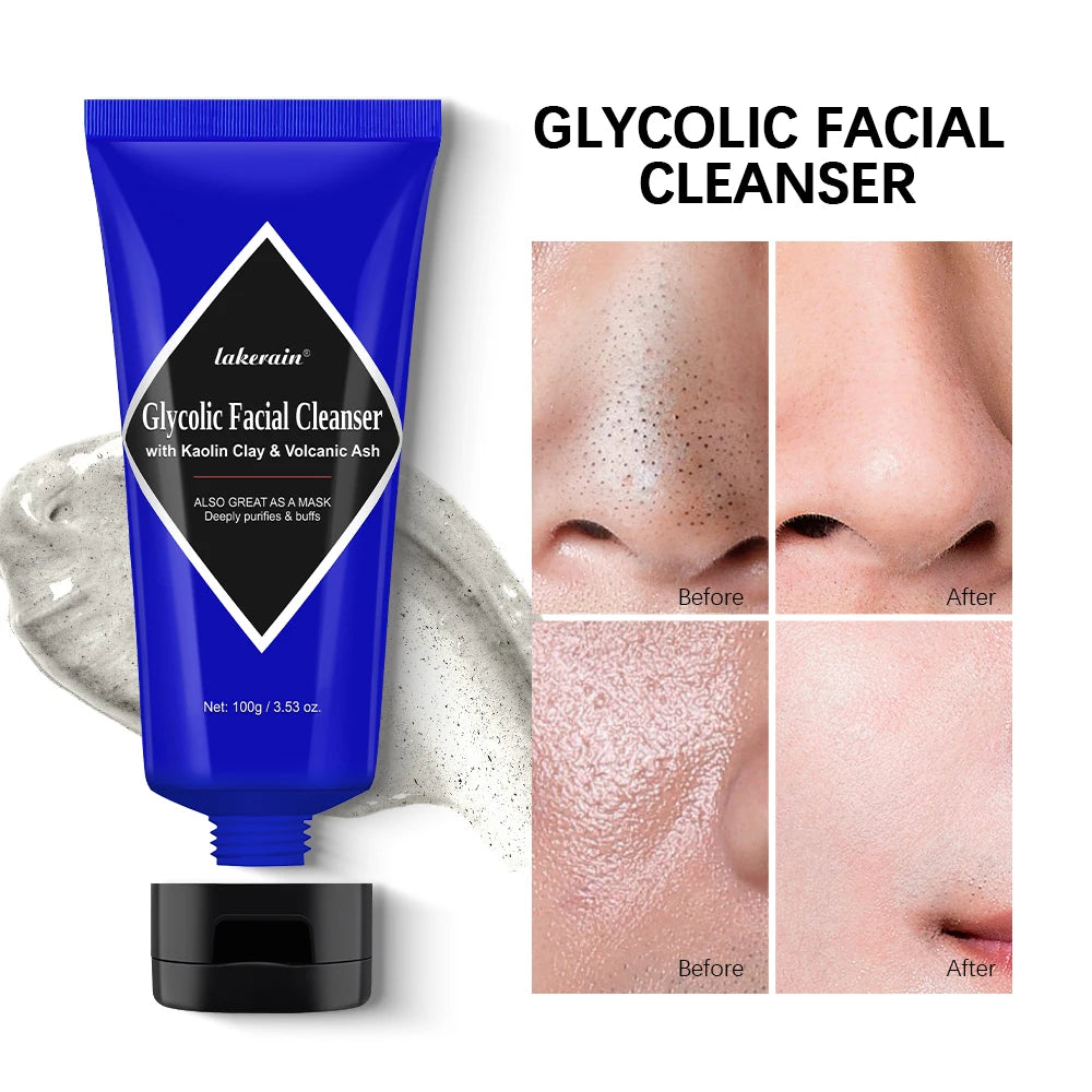 Glycolic Acid Clay Cleanser Deep Cleansing Face Wash 2-In-1 Cleansing Mask Blackhead Removal Oil Control For All Skin Types Oasis Select
