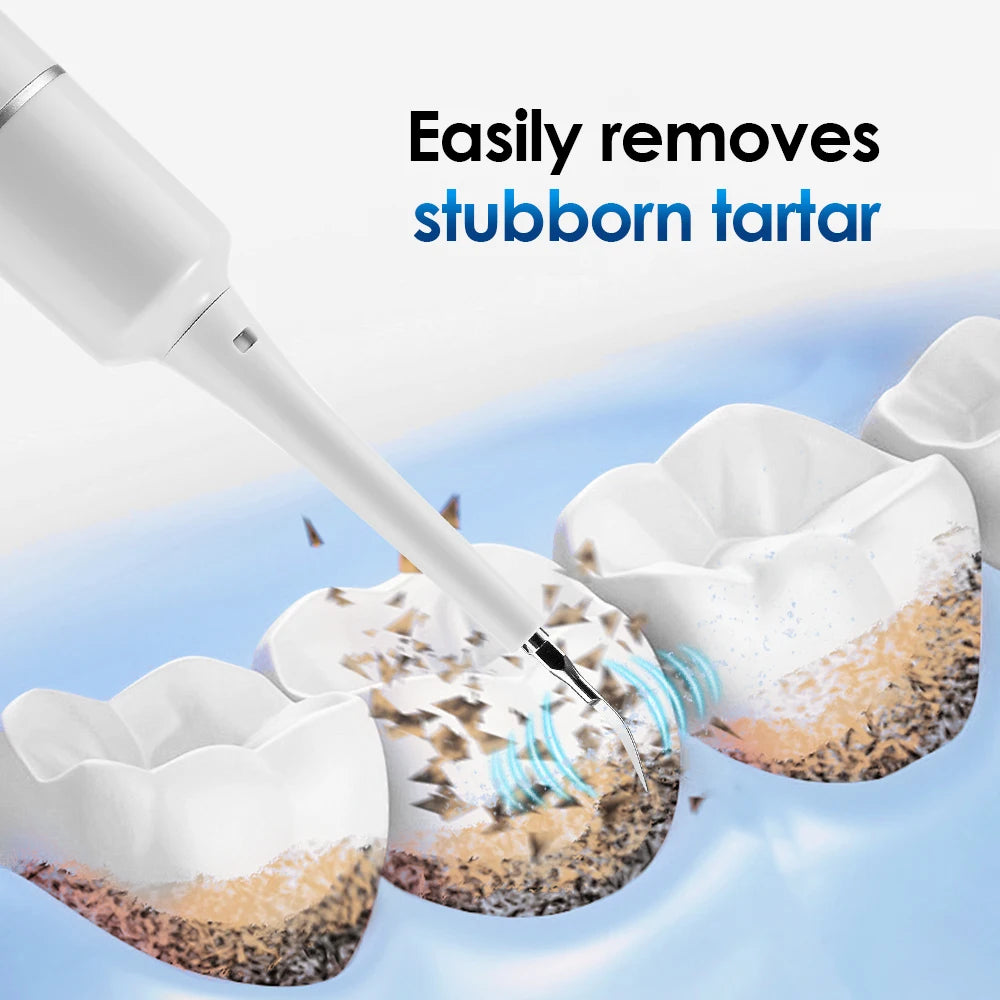 Ms.Dear Electric Tartar Remover & Whitening Toothbrush – 6 Modes