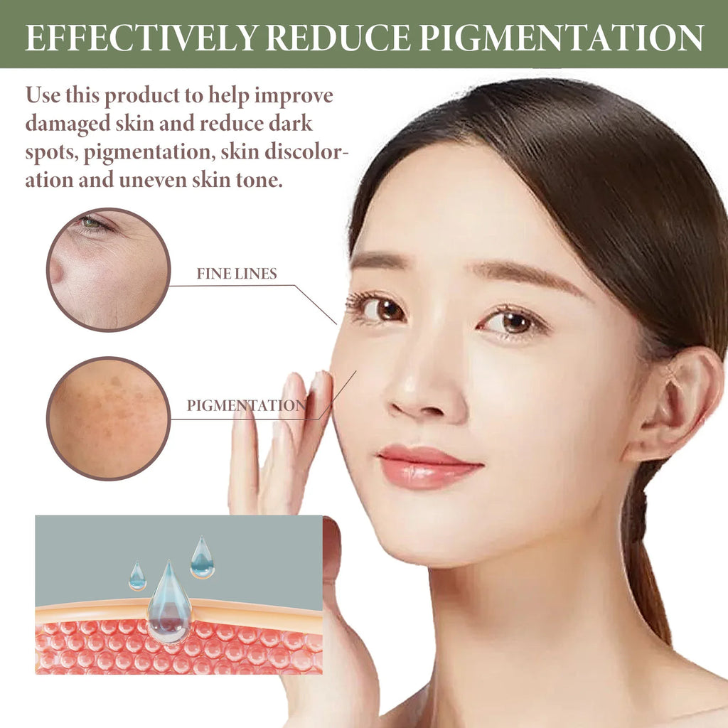 Dark Spots Removal Serum Fade Pigment Chloasma Melanin Brightening Freckle Improves Dull Pore Shrinking Facial Whitening Essence Oasis Select