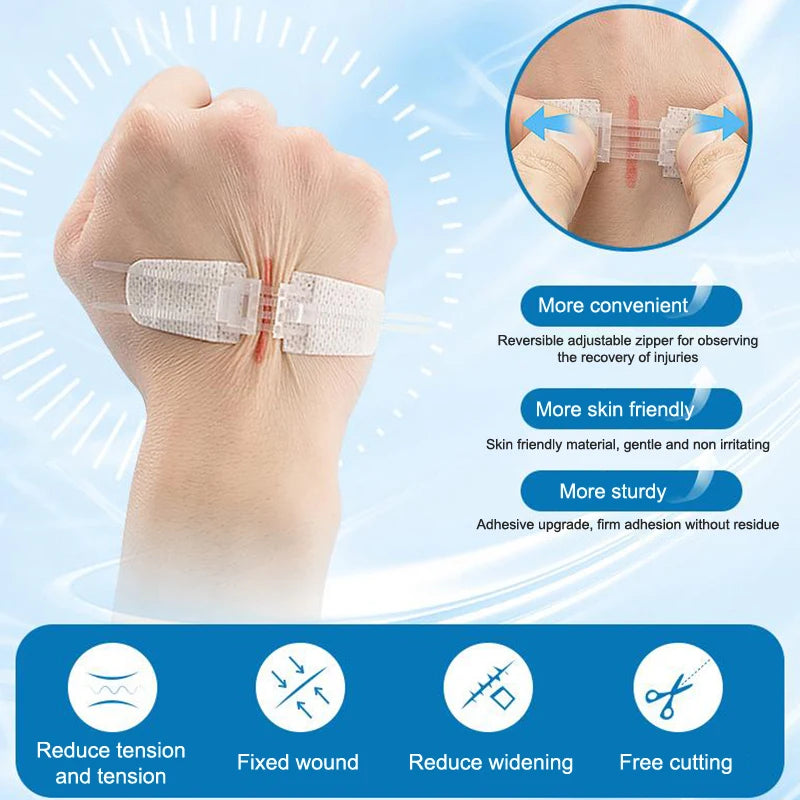 Zipper Wound Closure Strips | No-Suture Fast Closure Patch