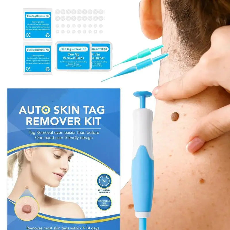Skin Tag Removal Tool Face Beauty Accessories Skin Tag Removal Device Multipurpose Supplies for Face Neck Chin Back Oasis Select