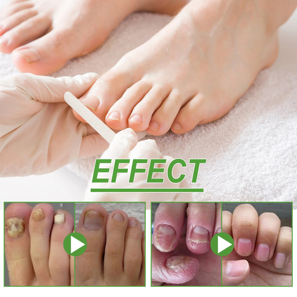 5-Day Nail Care Roller – Nourishing Nail Serum for Hand & Foot Nail Treatment Serum Oasis Select