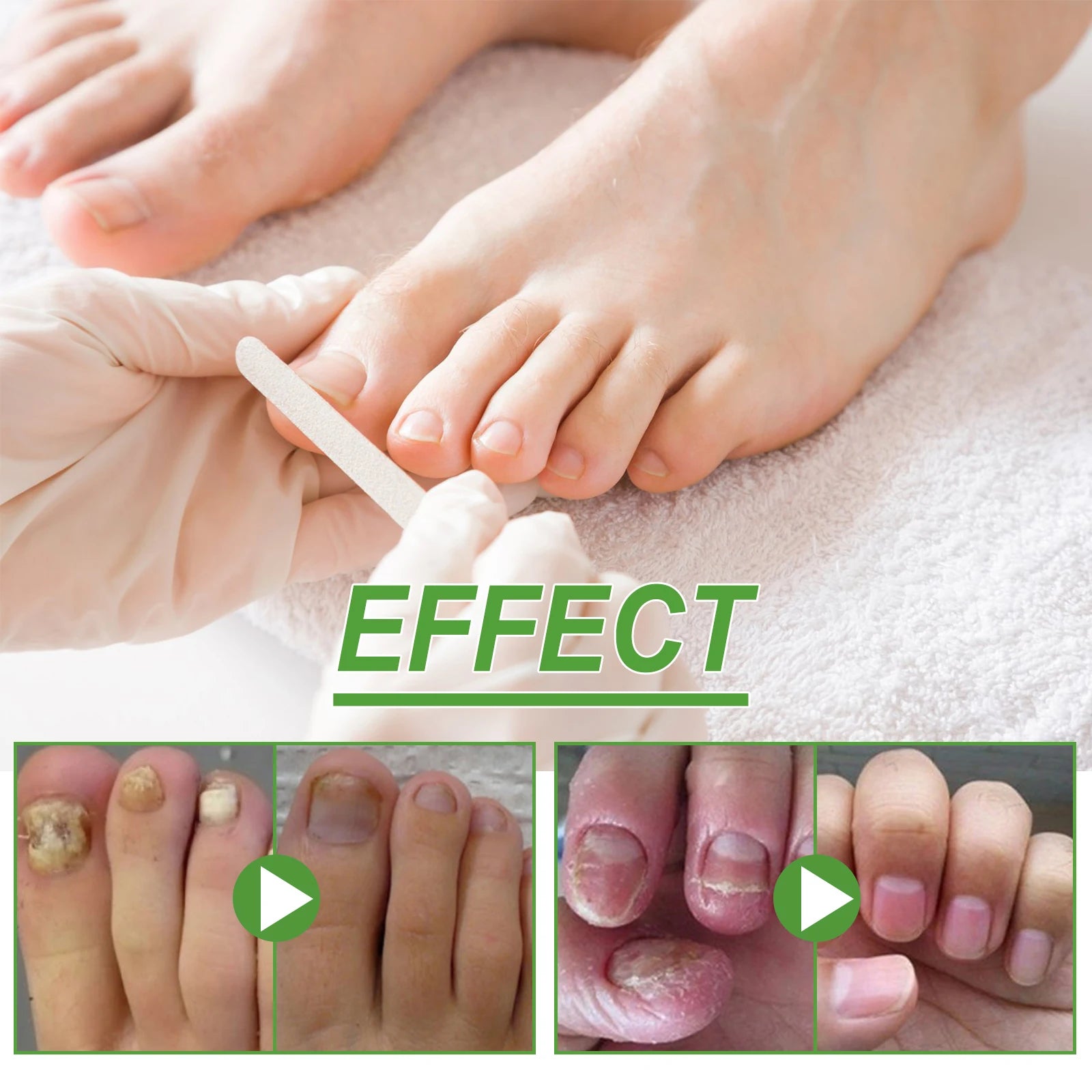 5-Day Nail Care Roller – Nourishing Nail Serum for Hand & Foot Nail Treatment Serum Oasis Select