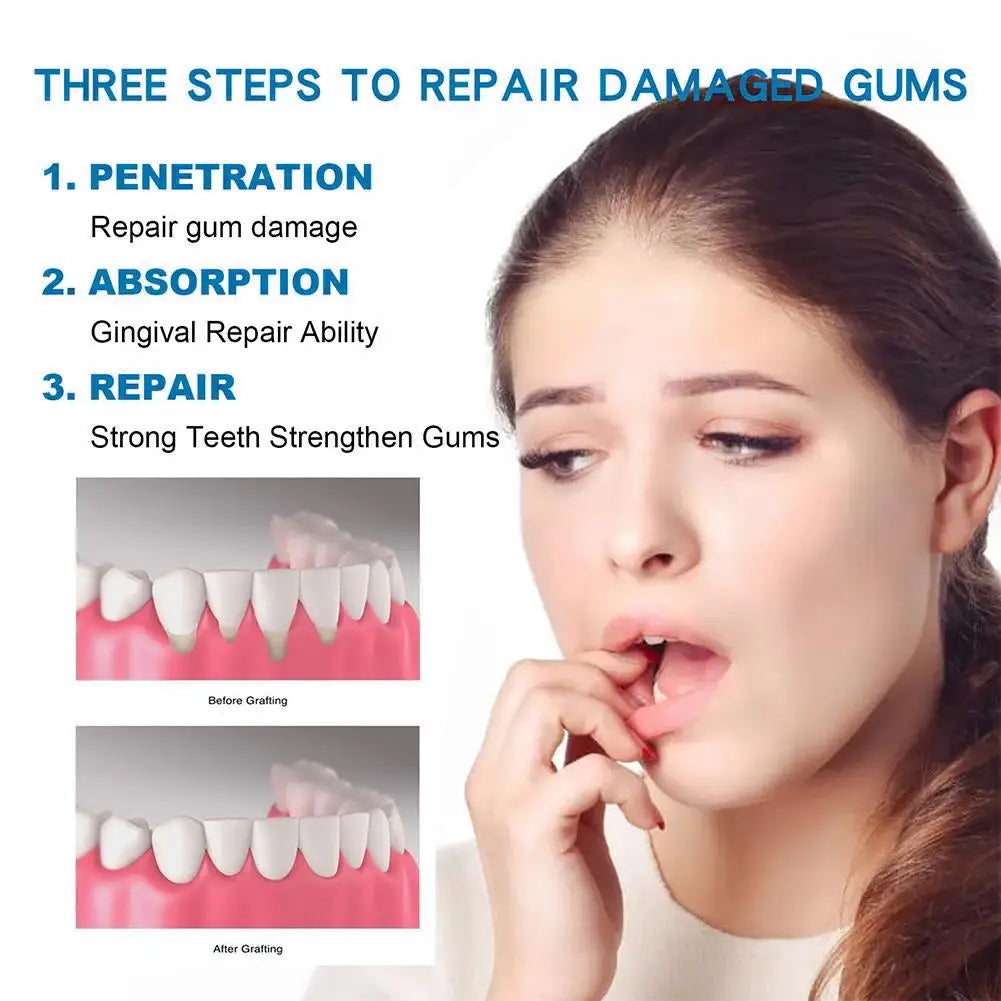 30ml Gum Repair Drops Relieve Sore Gums Allergy Deep Cleaning Teeth Stains Tartar Serum Tooth Pain Relief Spray Care Oasis Select