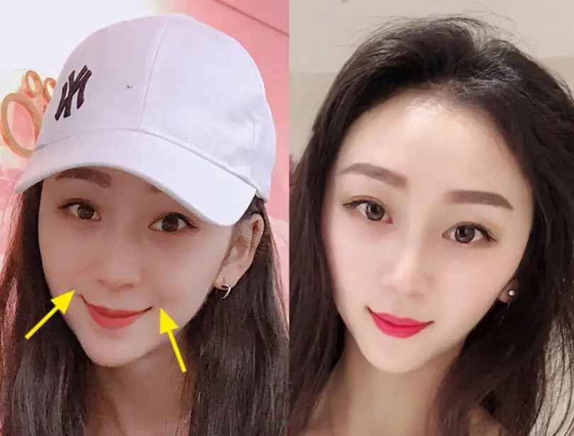 Silica Gel Jaw Exerciser – Face Lift & Chin Slimmer Tool Facial Exercise Tool Oasis Select