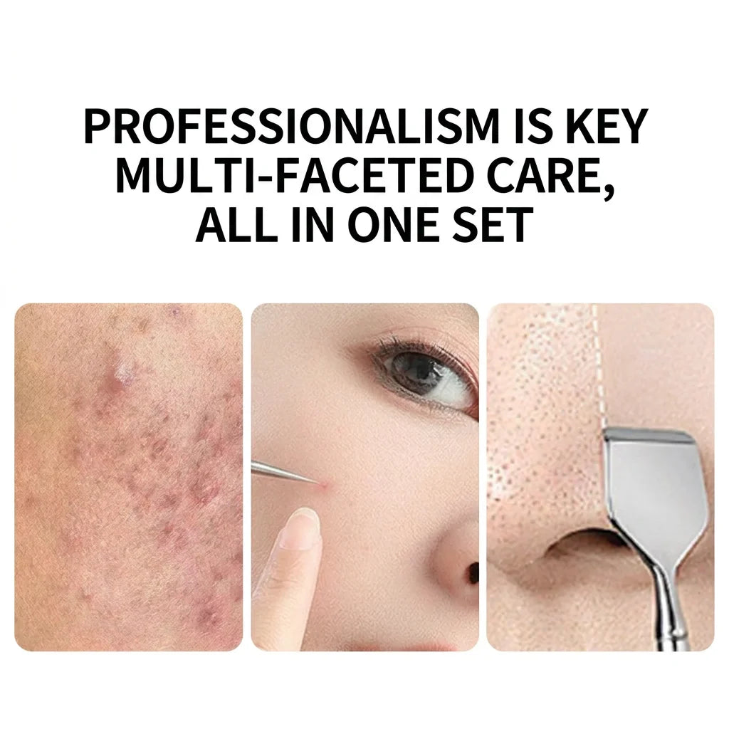 Stainless Steel Comedone Extractor & Blackhead Remover Kit