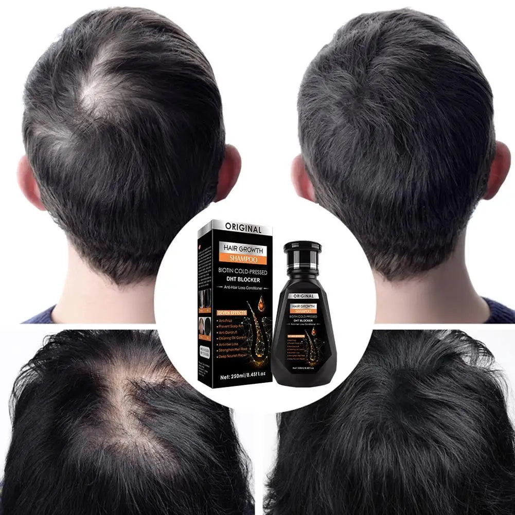 Biotin & Ginger Shampoo 250ml – Hair Growth & Thickening Hair Growth Shampoo Oasis Select