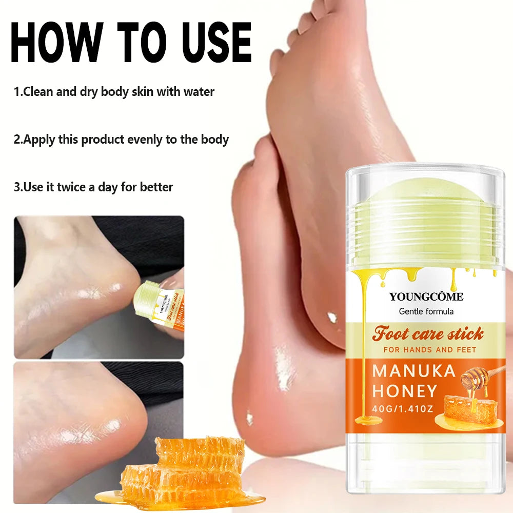 YOUNGCOME Foot Care Stick – Shea Butter, Urea & 24H Hydration
