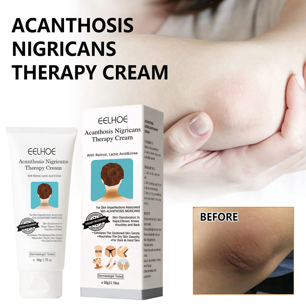 EELHOE Skin Brightening Whitening Cream – Neck, Elbow & Body Body Brightening Cream Oasis Select