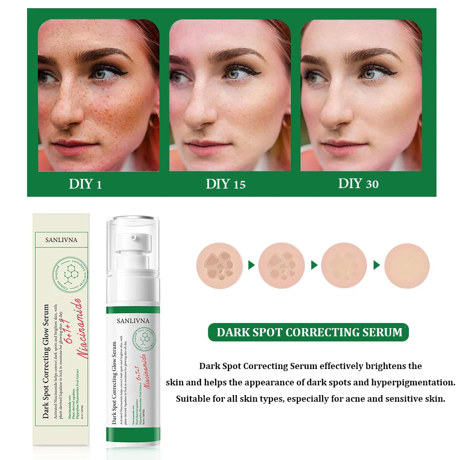 SANLIVNA Dark Spot Essence – Brightening Face Serum 50ml Brightening Face Serum Oasis Select