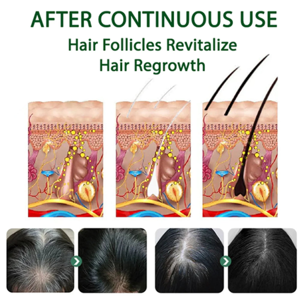 EELHOE Gray Hair Darkening Spray – Natural Black Hair Treatment Hair Darkening Spray Oasis Select