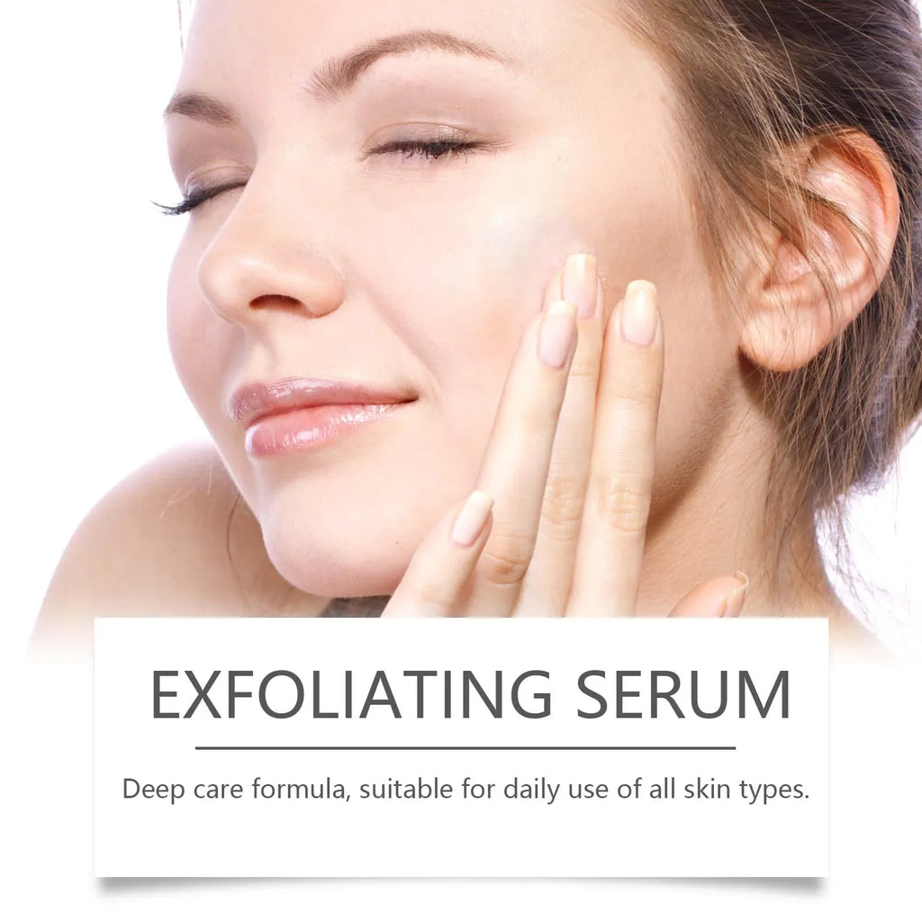 Hoygi Lactic Acid Exfoliating Serum – Acne & Pore Minimiser Exfoliating Face Serum Oasis Select